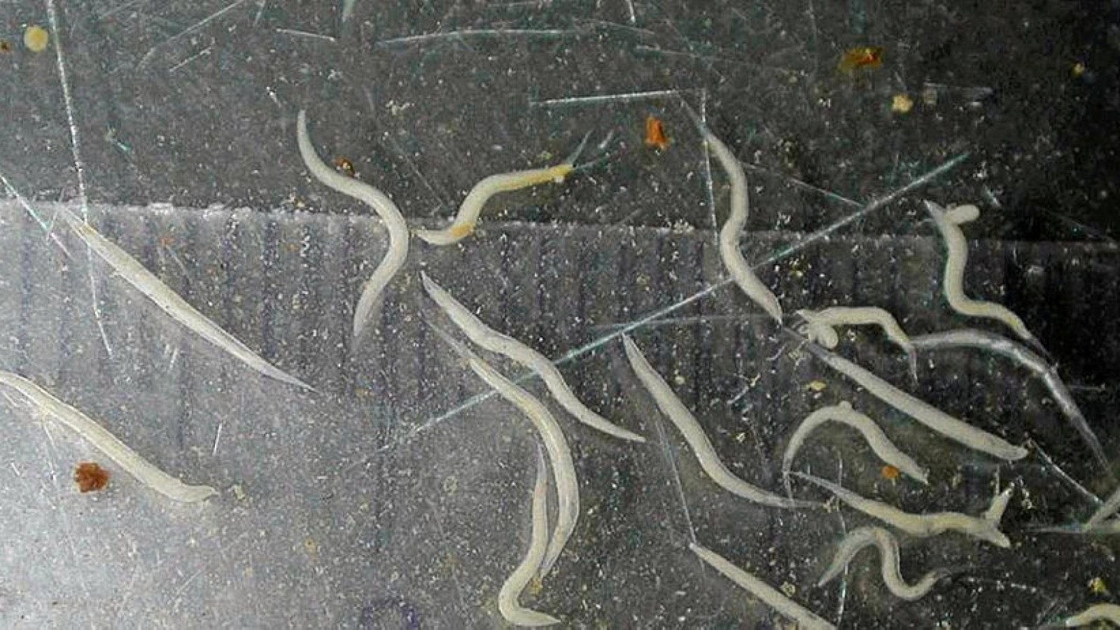 Wenn Würmer im Darm von Menschen leben