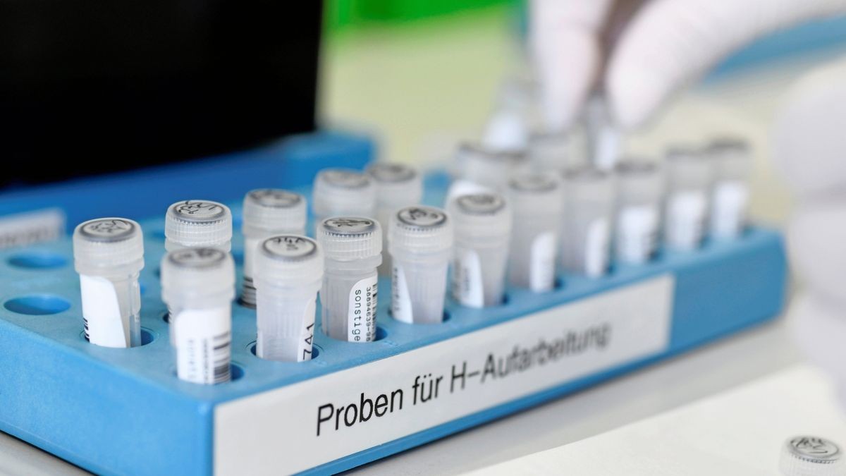 Sieben Proben wurden positiv auf den Covid-19-Virus getestet.