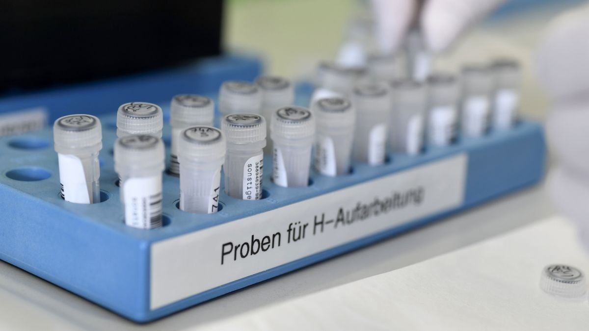 Am Institut für Medizinische Mikrobiologie am Universitätsklinikum Jena werden Proben auf das Coronavirus untersucht. Die Tests aus dem Kreis Saalfeld-Rudolstadt gehen überwiegend an ein Labor in Greiz.