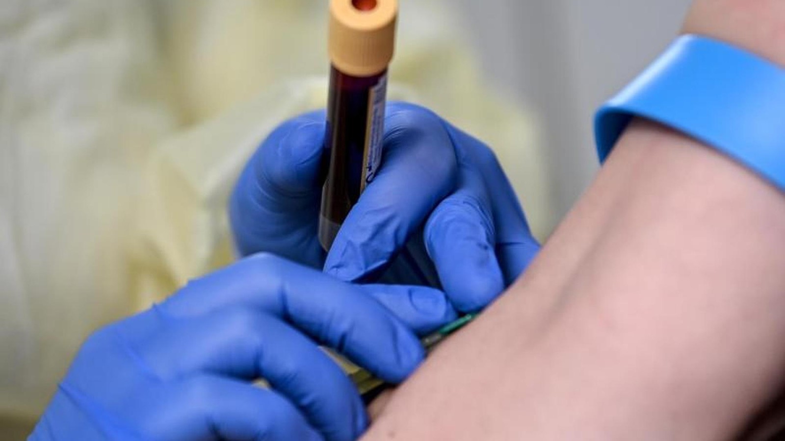 Warum-ich-Cholesterinwerte-eines-alten-dicken-Mannes-habe