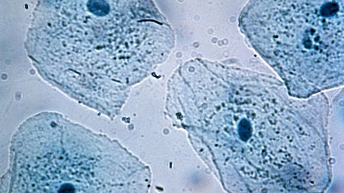Blau ist die Farbe der Hoffnung in der Alzheimer-Forschung