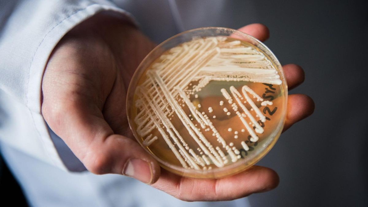 Eine Petrischale mit dem Hefepilz Candida auris. In Deutschland werden immer mehr Fälle des krankmachenden Pilzes bekannt.