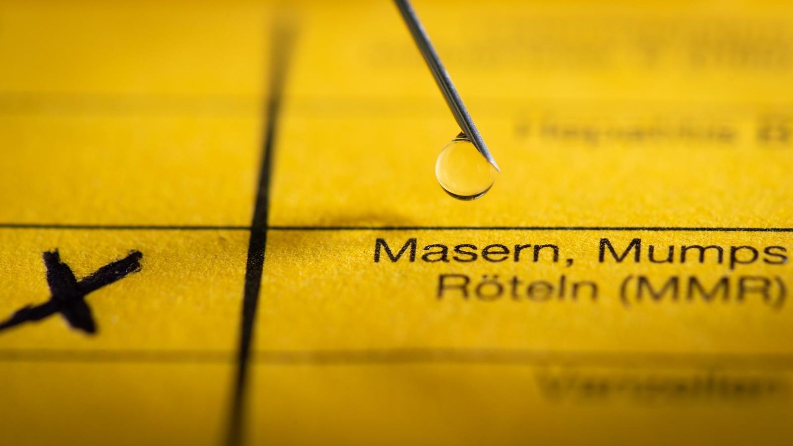 Zwei-Masern-F-lle-in-Hemer-Gesundheitsamt-gibt-Hinweise