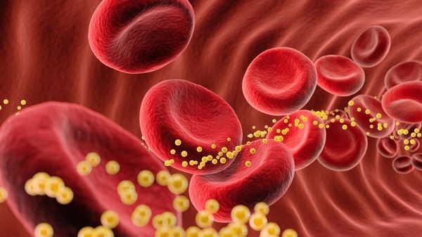 LDL-Cholesterin: Warum es unterschiedliche Grenzwerte gibt