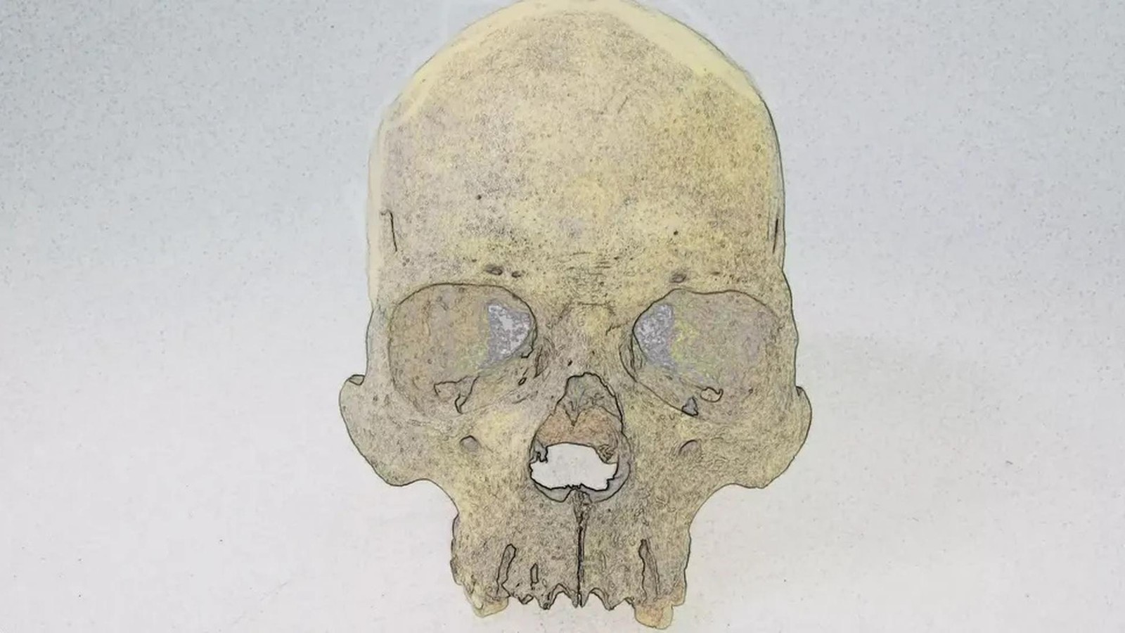 Chile-Forscher-entdecken-4000-Jahre-alte-Infektionskrankheit