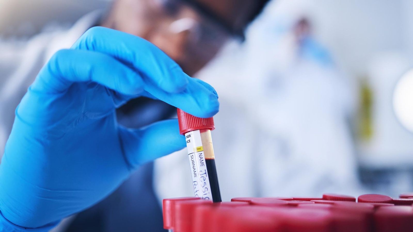 Neuer Turbo-Test des Robert Koch-Instituts: Revolution in der Viren-Diagnostik?