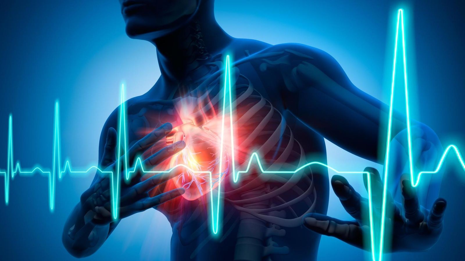Herzinfarkt-Hier-sterben-die-Menschen-am-h-ufigsten