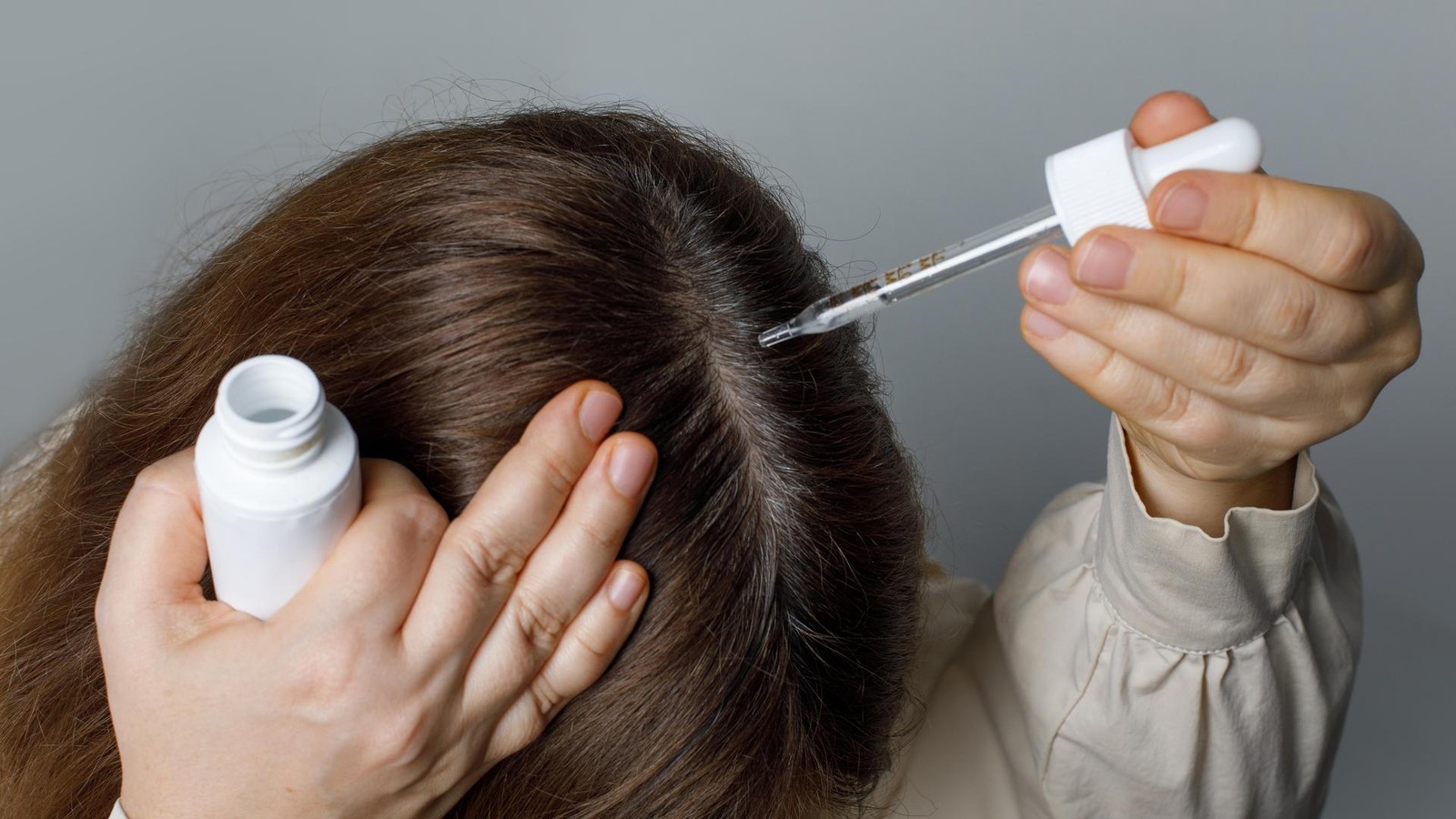 Dichteres-Haar-durch-Minoxidil-Erstmal-fallen-die-Haare-aus-