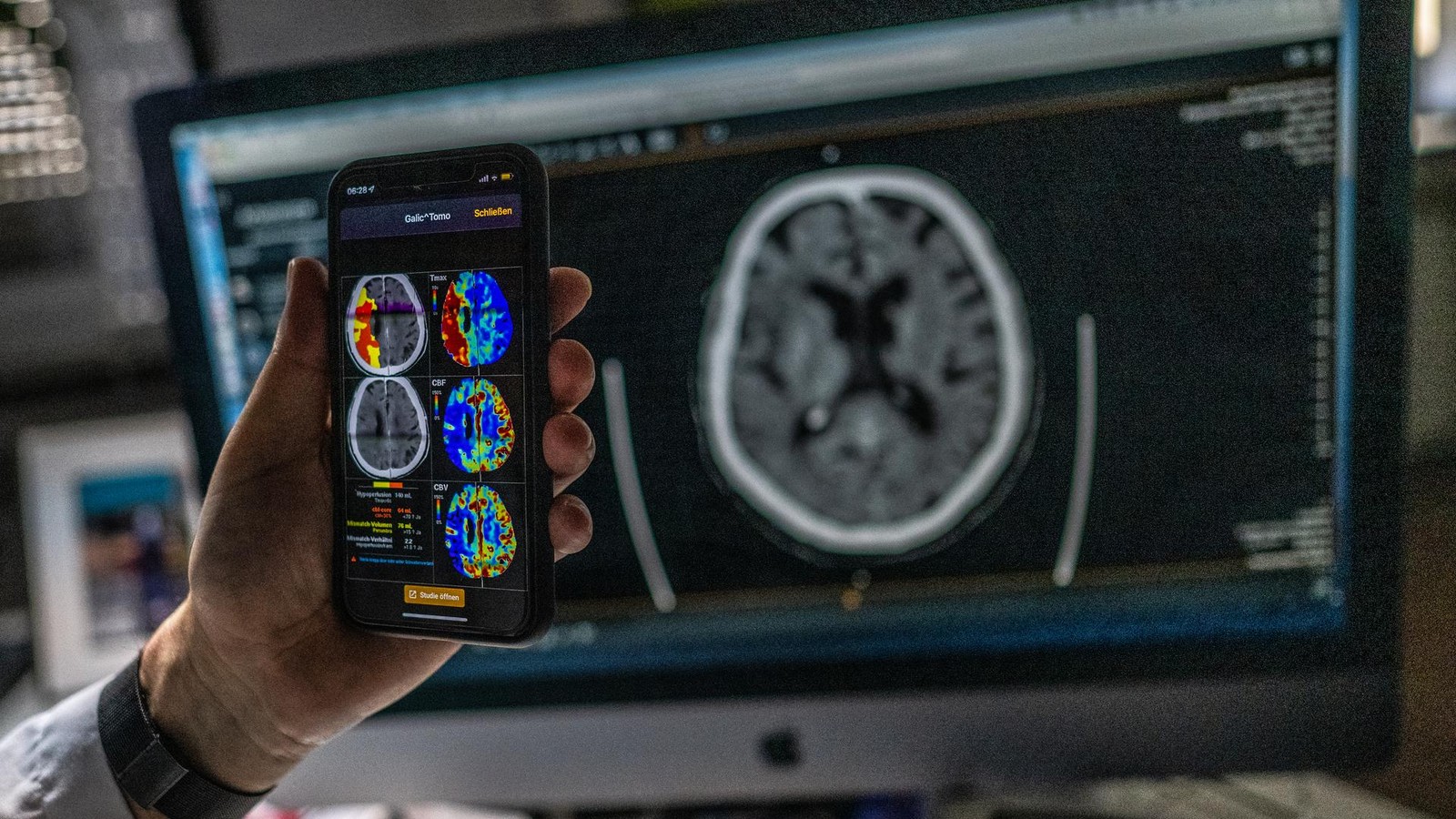 Schlaganfall-Jede-Minute-entscheidet-ber-das-Ausma-der-Sch-den-