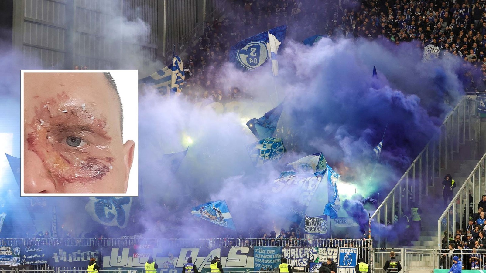 -es-gab-kein-entkommen-schalke-fan-wird-im-block-von-pyro-fackel-verletzt