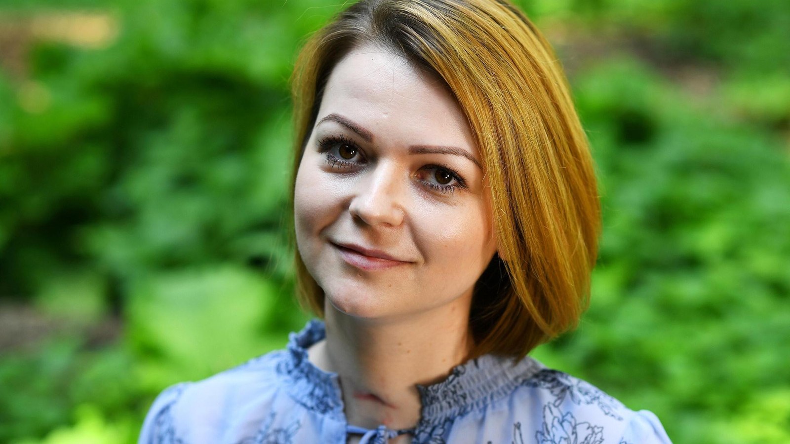 -Aug-pfel-zuckten-So-f-hlt-sich-eine-Vergiftung-durch-Putins-Spione-an