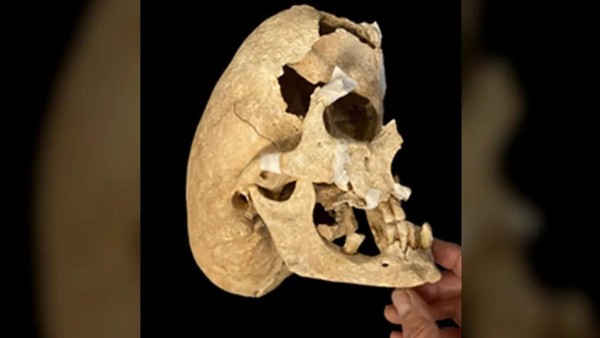 Spanien: Archäologen rätseln über seltsame Schädelform eines Ritters