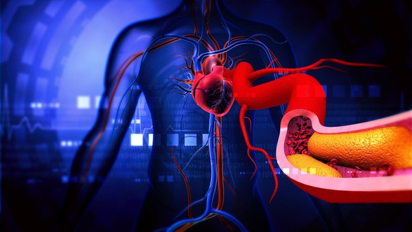 Mit Statinen gegen Cholesterin: Ärztin räumt mit „Angstmache“ zu Gefahren auf