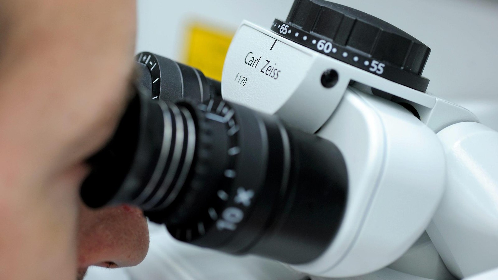 Carl-Zeiss-Meditec-berrascht-negativ-Was-das-Unternehmen-aus-Jena-belastet