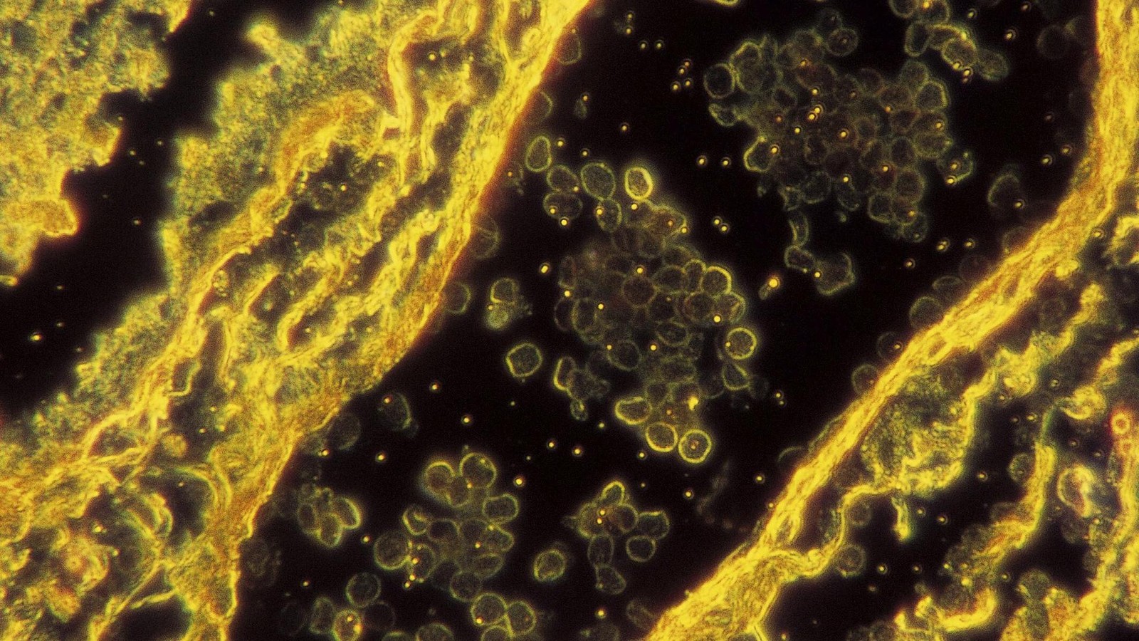 Studie-Bekannte-Geschlechtskrankheit-existiert-seit-5500-Jahren