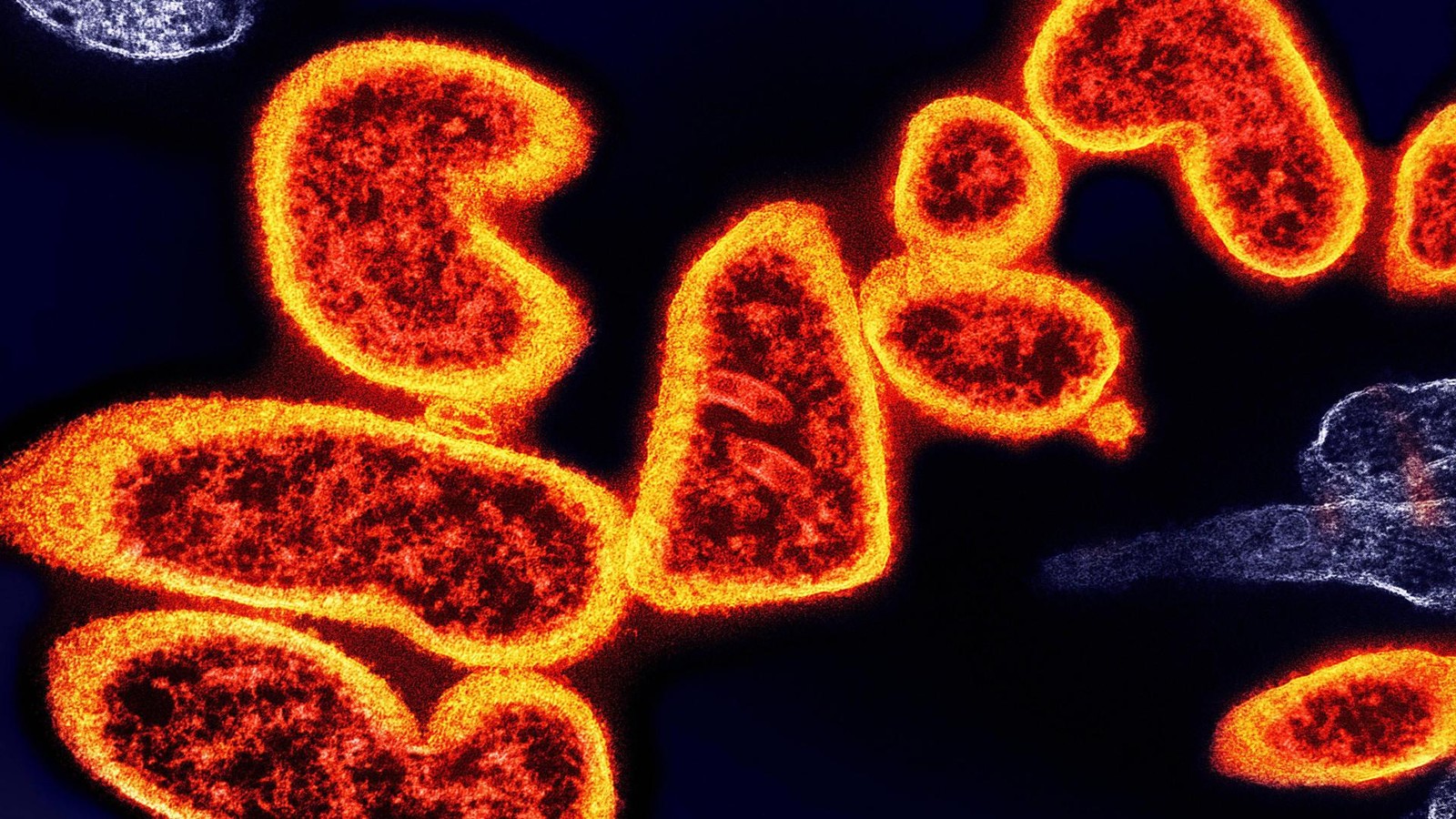 Nipah-Virus-Ausbruch-in-Indien-alarmiert-Asien-Flughafenkontrollen-versch-rft