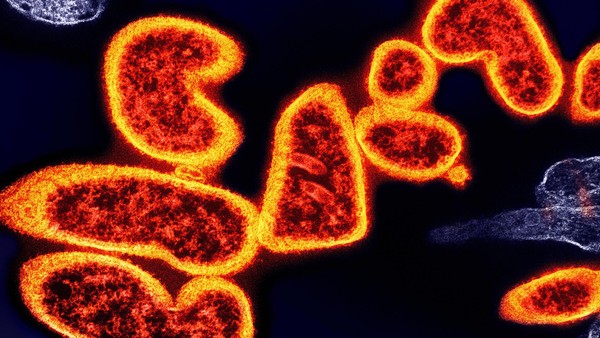 Nipah-Virus-Ausbruch in Indien alarmiert Asien: Flughafenkontrollen verschärft